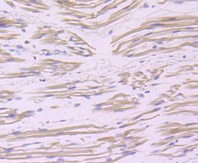 Immunohistochemistry-Paraffin: BAG3 Antibody (JA90-53) [NBP2-67177] - Analysis of paraffin-embedded human fetal skeletal muscle tissue using anti-Bag3 antibody. Counter stained with hematoxylin.