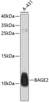 Western Blot BAGE2 Antibody - BSA Free