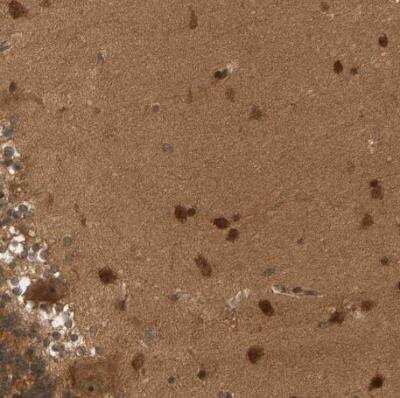 Immunohistochemistry-Paraffin: BAHCC1 Antibody [NBP1-91067] -  Staining of human cerebellum shows strong positivity in nucleoli and cytoplasm in Purkinje cells and cells in molecular layers.