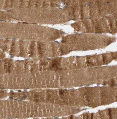 Immunohistochemistry-Paraffin: BAHCC1 Antibody [NBP1-91067] - Staining of human skeletal muscle shows strong cytoplasmic positivity in myocytes.