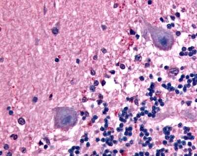 Immunohistochemistry-Paraffin: BAI1 Antibody [NLS989] - Analysis of anti-BAI1 antibody with human brain, neurons.