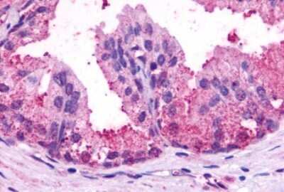 Immunohistochemistry-Paraffin: BAI1 Antibody [NLS989] - Anti-BAI1 antibody IHC of human prostate, benign prostatic hyperplasia. Immunohistochemistry of formalin-fixed, paraffin-embedded tissue after heat-induced antigen retrieval.