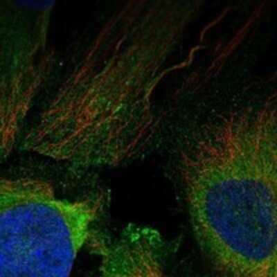 Immunocytochemistry/Immunofluorescence: BAI2 Antibody [NBP3-17807] - Staining of human cell line HeLa shows localization to plasma membrane.