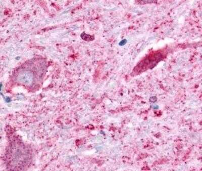 Immunohistochemistry-Paraffin: BAI2 Antibody [NLS984] - Human brain, neurons tissue after heat-induced antigen retrieval.