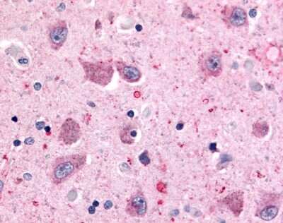 Immunohistochemistry-Paraffin: BAI2 Antibody [NLS982] - Analysis of anti-BAI2 antibody with human brain, neurons and glia.