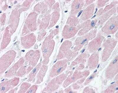 Immunohistochemistry-Paraffin: BAI3 Antibody [NBP1-50518] - Analysis of anti-BAI3 antibody with human heart at concentration 15 ug/ml.