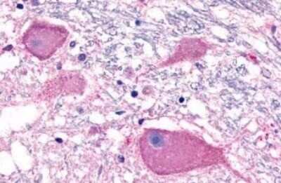 Immunohistochemistry-Paraffin: BAI3 Antibody [NLS978] - Anti-BAI3 antibody IHC of human brain, neurons. Immunohistochemistry of formalin-fixed, paraffin-embedded tissue after heat-induced antigen retrieval.