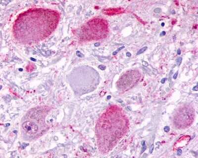 Immunohistochemistry-Paraffin: BAI3 Antibody [NLS979] - Analysis of anti-BAI3 antibody with human brain, neurons at 4 ug/ml.