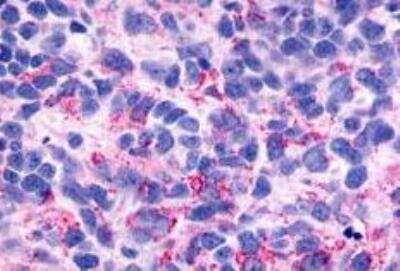 Immunohistochemistry-Paraffin BAI3 Antibody - BSA Free