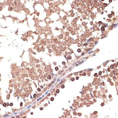 Immunohistochemistry-Paraffin: BANF1 Antibody (6J8O2) [NBP3-16263] - Immunohistochemistry of paraffin-embedded rat testis using BANF1 Rabbit mAb (NBP3-16263) at dilution of 1:100 (40x lens).Perform microwave antigen retrieval with 10 mM Tris/EDTA buffer pH 9.0 before commencing with IHC staining protocol.