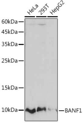 Western Blot: BANF1 Antibody (6J8O2) [NBP3-16263] - Western blot analysis of extracts of various cell lines, using BANF1 Rabbit mAb (NBP3-16263) at 1:1000 dilution. Secondary antibody: HRP Goat Anti-Rabbit IgG (H+L) at 1:10000 dilution. Lysates/proteins: 25ug per lane. Blocking buffer: 3% nonfat dry milk in TBST. Detection: ECL Basic Kit. Exposure time: 60s.