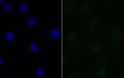 Immunocytochemistry/Immunofluorescence: BANF1 Antibody (JG40-43) [NBP2-76978] - ICC staining BANF1 in A549 cells (green). The nuclear counter stain is DAPI (blue). Cells were fixed in paraformaldehyde, permeabilised with 0.25% Triton X100/PBS.