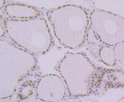 Immunohistochemistry: BANF1 Antibody (JG40-43) [NBP2-76978] - Immunohistochemical analysis of paraffin-embedded human thyroid gland tissue using anti-BANF1 antibody. Counter stained with hematoxylin.