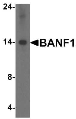 Western Blot: BANF1 Antibody [NBP1-76751] - Analysis in Hela cell lysate with antibody at 1 ug/mL.