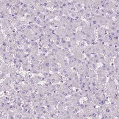 Immunohistochemistry-Paraffin: BANF2 Antibody [NBP1-88718] - Staining of human liver shows no positivity in hepatocytes as expected.