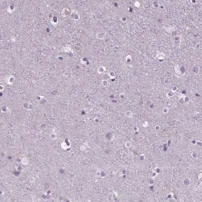 Immunohistochemistry-Paraffin: BANF2 Antibody [NBP1-88718] - Staining of human cerebral cortex shows no positivity in neurons as expected.