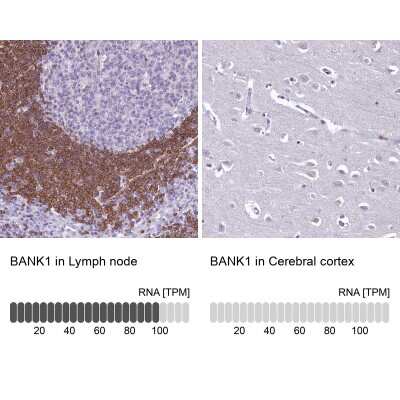 Immunohistochemistry-Paraffin BANK1 Antibody