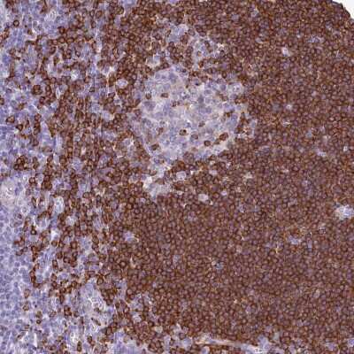 Immunohistochemistry-Paraffin BANK1 Antibody