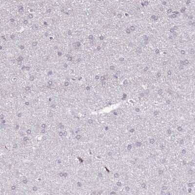 Immunohistochemistry-Paraffin BANK1 Antibody