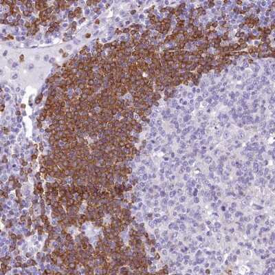 Immunohistochemistry-Paraffin: BANK1 Antibody [NBP1-88714] - Staining of human lymph node shows moderate to strong cytoplasmic positivity in germinal center cells.