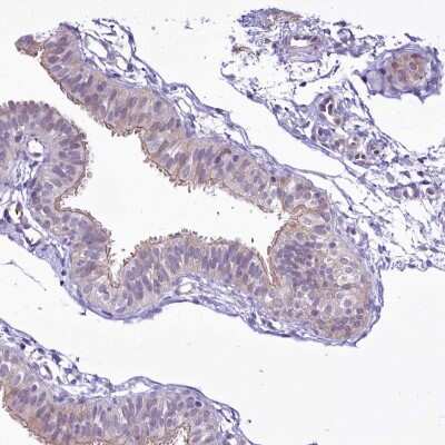 Immunohistochemistry-Paraffin: BANK1 Antibody [NBP1-88714] - Staining of human fallopian tube shows weak to moderate cytoplasmic positivity in glandular cells.