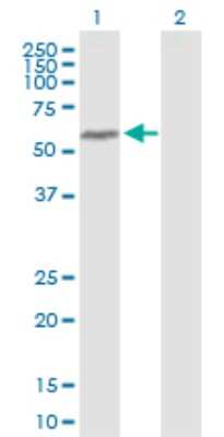 Western Blot: BANP Antibody [H00054971-B01P] - Analysis of BANP expression in transfected 293T cell line by BANP polyclonal antibody.  Lane 1: BANP transfected lysate(51.59 KDa). Lane 2: Non-transfected lysate.
