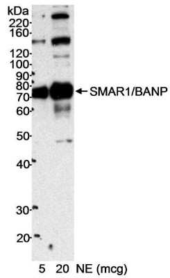 Western Blot: BANP Antibody [NB100-79784] - Nuclear extract (NE) from HeLa cells. Antibody used at 0.1 ug/ml.