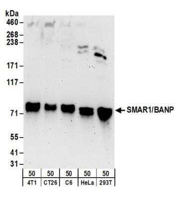 Western Blot: BANP Antibody [NB100-79784] - Detection of Human, Mouse and Rat SMAR1/BANP by Western Blot. Samples: Whole cell lysate (50 ug) from mouse 4T1, mouse CT26.WT, rat C6, HeLa, and 293T cells. Antibodies: Affinity purified rabbit anti-SMAR1/BANP antibody NB100-79784 used for WB at 0.1 ug/ml. Detection: Chemiluminescence with an exposure time of 3 minutes.