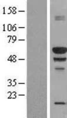 Western Blot: BANP Overexpression Lysate (Adult Normal) [NBP2-05793] Left-Empty vector transfected control cell lysate (HEK293 cell lysate); Right -Over-expression Lysate for BANP.