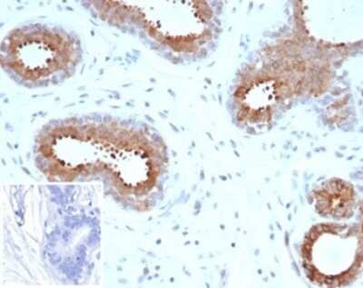 Immunohistochemistry-Paraffin BAP1 Antibody (BAP1/6861R)