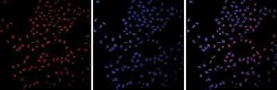 Immunocytochemistry/Immunofluorescence: BAP1 Antibody (C.15200212) [NBP2-59268] - HeLa cells were stained with the antibody (left) diluted 1:1,000 in blocking solution followed by an anti-mouse antibody conjugated to Alexa Fluor 594. The middle panel shows staining of the nuclei with DAPI. A merge of the two stainings is shown on the right.