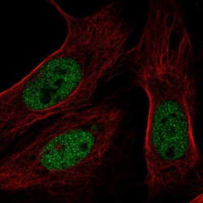 Immunocytochemistry/Immunofluorescence: BAP1 Antibody [NBP2-55462] - Staining of human cell line U-2 OS shows localization to nucleoplasm.