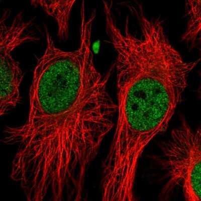 Immunocytochemistry/Immunofluorescence: BAP1 Antibody [NBP2-57089] - Staining of human cell line HeLa shows localization to nucleoplasm. Antibody staining is shown in green.