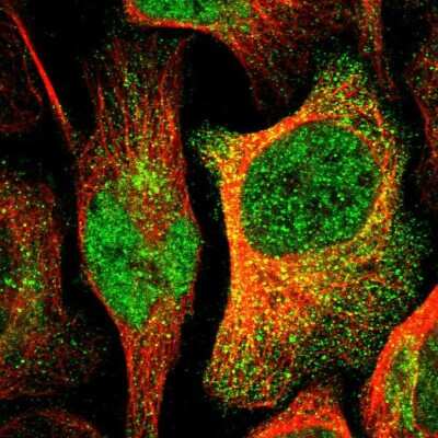 Immunocytochemistry/Immunofluorescence: BAP18 Antibody [NBP1-82671] - Immunofluorescent staining of human cell line U-2 OS shows localization to nucleoplasm & cytosol.