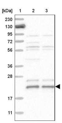Western Blot: BAP18 Antibody [NBP1-82671] - Lane 1: Marker  [kDa] 230, 130, 95, 72, 56, 36, 28, 17, 11.  Lane 2: Human cell line RT-4.  Lane 3: Human cell line U-251MG sp