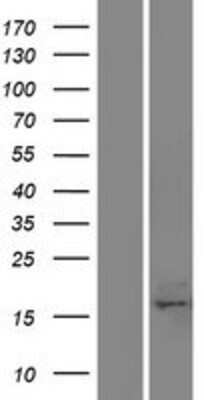 Western Blot: BAP18 Overexpression Lysate (Adult Normal) [NBP2-05073] Left-Empty vector transfected control cell lysate (HEK293 cell lysate); Right -Over-expression Lysate for BAP18.