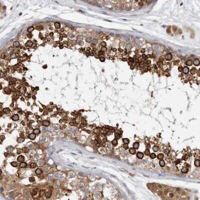 Immunohistochemistry-Paraffin BAP29 Antibody - BSA Free
