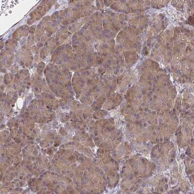 Immunohistochemistry-Paraffin BAP29 Antibody