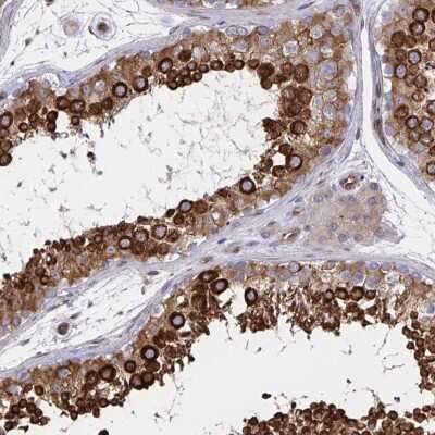 Immunohistochemistry-Paraffin BAP29 Antibody