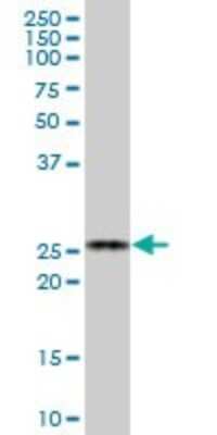 Western Blot: BAP29 Antibody [H00055973-B01P] - Analysis of BCAP29 expression in human liver.