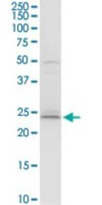 Western Blot: BAP29 Antibody [H00055973-D01P] - Analysis of BCAP29 expression in PC-12.