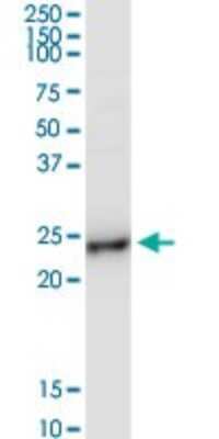 Western Blot: BAP29 Antibody [H00055973-D01P] - Analysis of BCAP29 expression in human placenta.