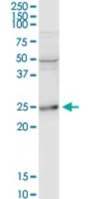 Western Blot: BAP29 Antibody [H00055973-D01P] - Analysis of BCAP29 expression in rat brain.