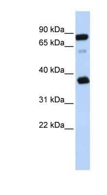 Western Blot: BAP29 Antibody [NBP1-62732] - Titration: 0.2-1 ug/ml, Positive Control: Jurkat cell lysate.