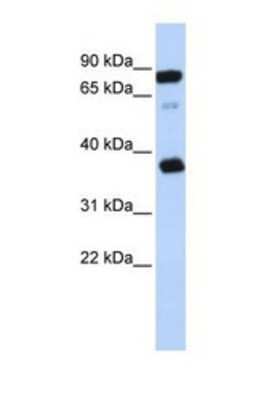 Western Blot: BAP29 Antibody [NBP1-69711] - This Anti-BCAP29 antibody was used in Western Blot of Jurkat tissue lysate at a concentration of 1ug/ml.