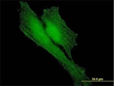 Immunocytochemistry/Immunofluorescence: BARD1 Antibody (2A11) [H00000580-M01] - Analysis of monoclonal antibody to BARD1 on HeLa cell . Antibody concentration 10 ug/ml.