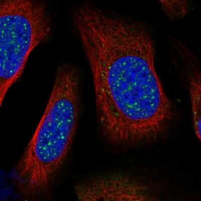 Immunocytochemistry/Immunofluorescence: BARD1 Antibody [NBP2-55593] - Staining of human cell line U-2 OS shows localization to nuclear speckles.