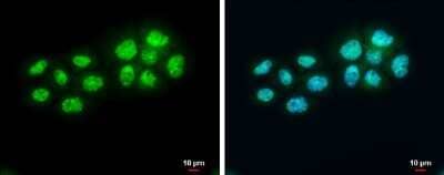 Immunocytochemistry/Immunofluorescence: BARD1 Antibody [NBP3-13065] - BARD1 antibody detects BARD1 protein at nucleus by immunofluorescent analysis. Sample: A431 cells were fixed in 4% paraformaldehyde at RT for 15 min. Green: BARD1 protein stained by BARD1 antibody (NBP3-13065) diluted at 1:500. Blue: Hoechst 33342 staining. Scale bar = 10 um.