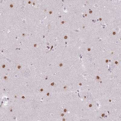 <b>Orthogonal Strategies Validation. </b>Immunohistochemistry: BARD1 Antibody [NBP2-47543] - Staining of human lateral ventricle shows strong nuclear positivity in neuronal cells.