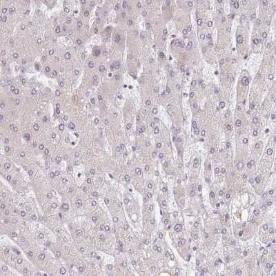 Immunohistochemistry-Paraffin: BARD1 Antibody [NBP2-47543] - Staining of human liver shows low expression as expected.